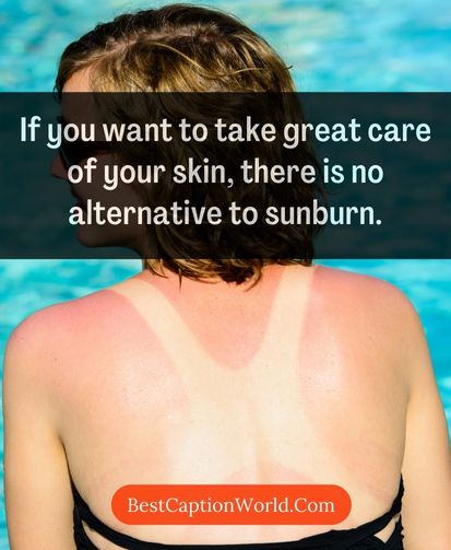 Powerful-Sunburn-Quotes